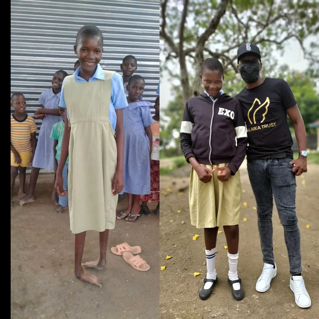  DADDY OWEN ATOA WITO KWA WAHISANI KUWASAIDIA WATOTO WENYE UGONJWA WA CLUB FOOT.